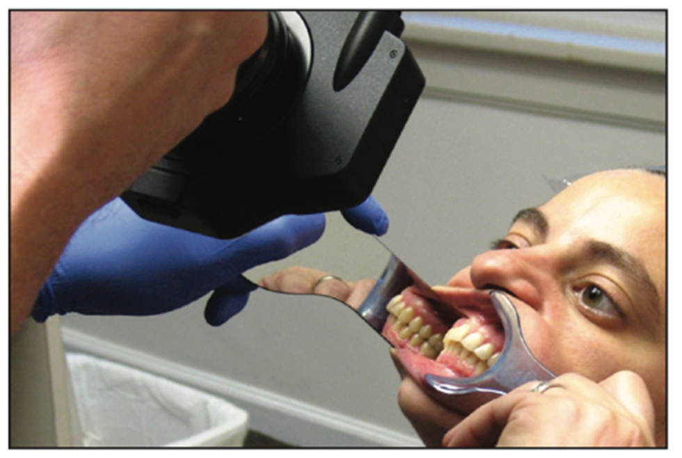 dental photography