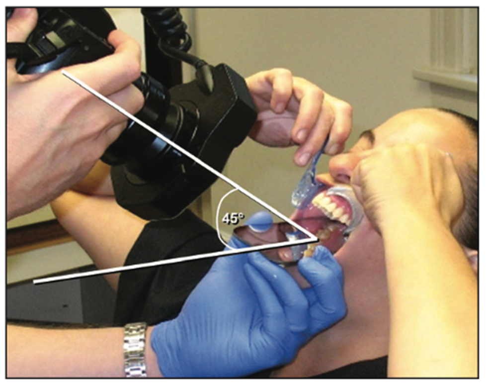 dental photography
