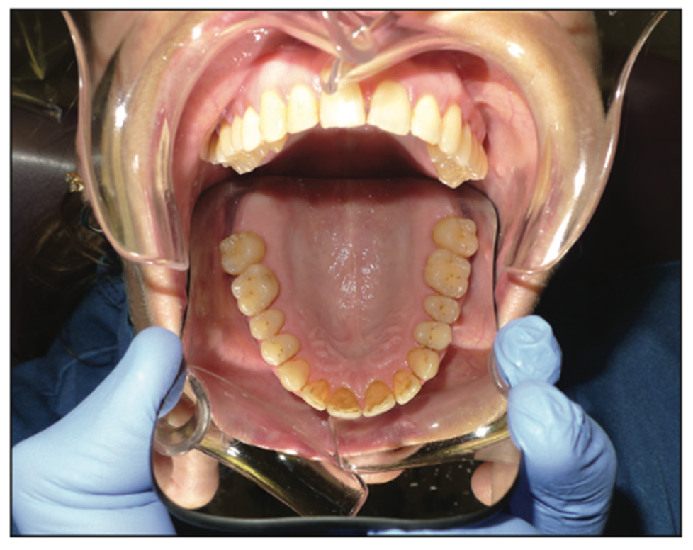 dental photography