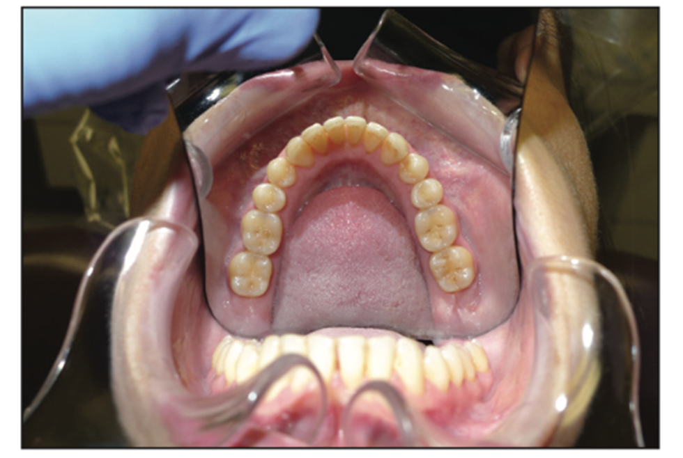 dental photography