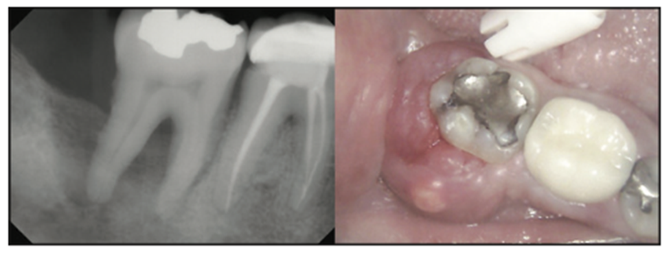 dental photography