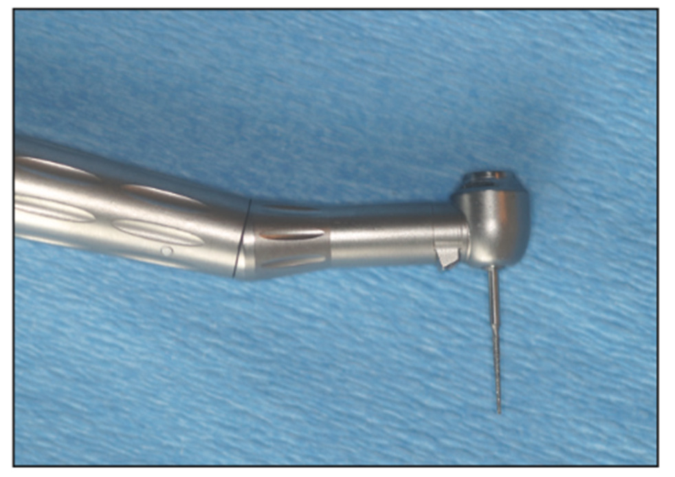 extraction complications