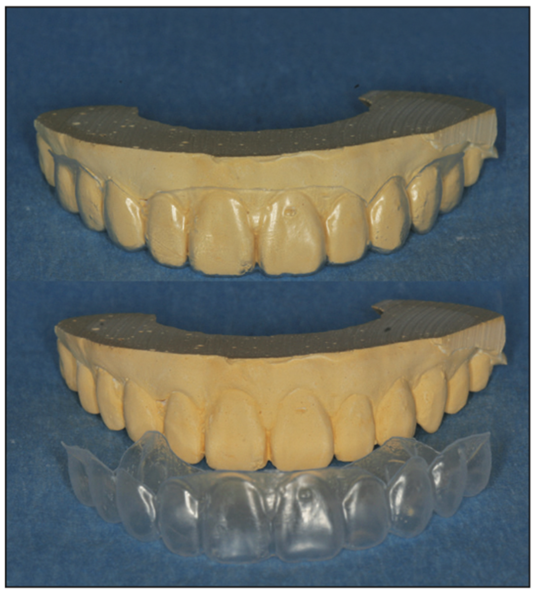 deciduous canines