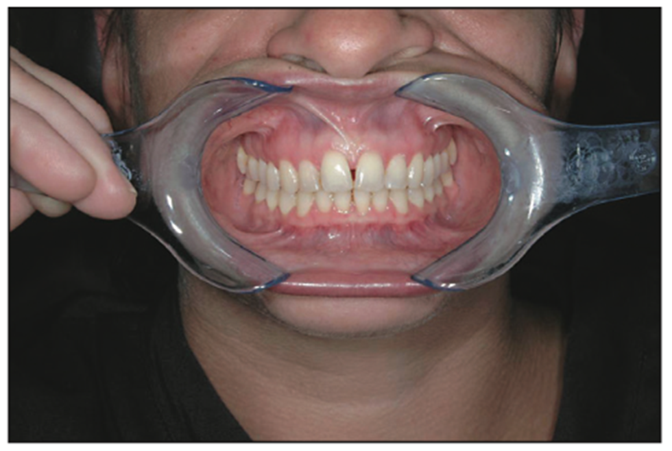 dental photography
