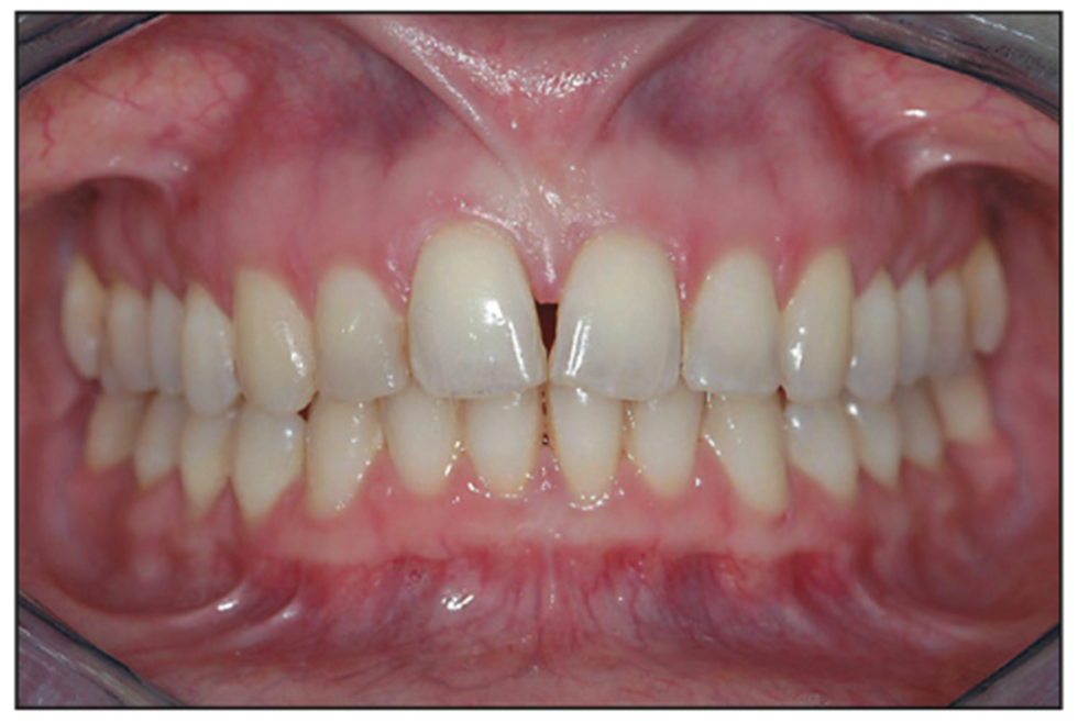 dental photography