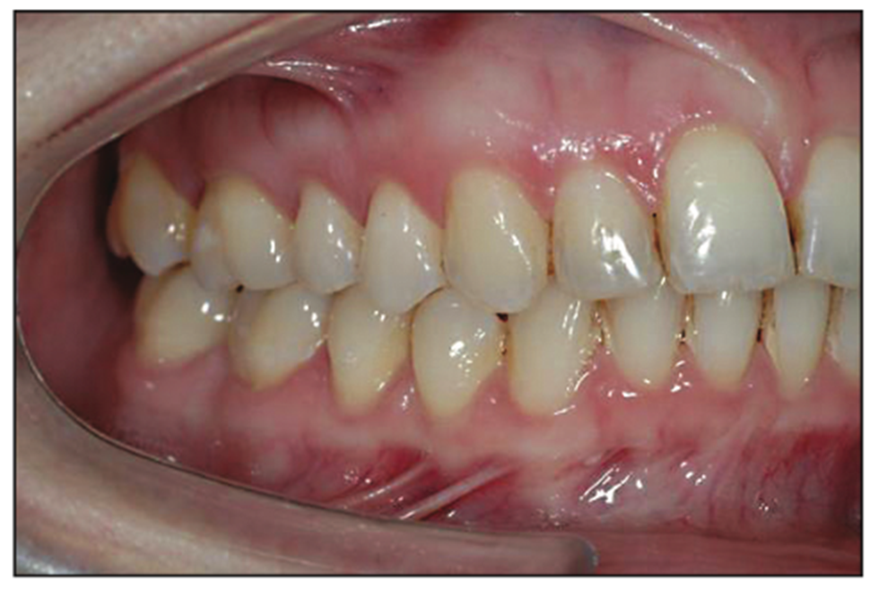 dental photography