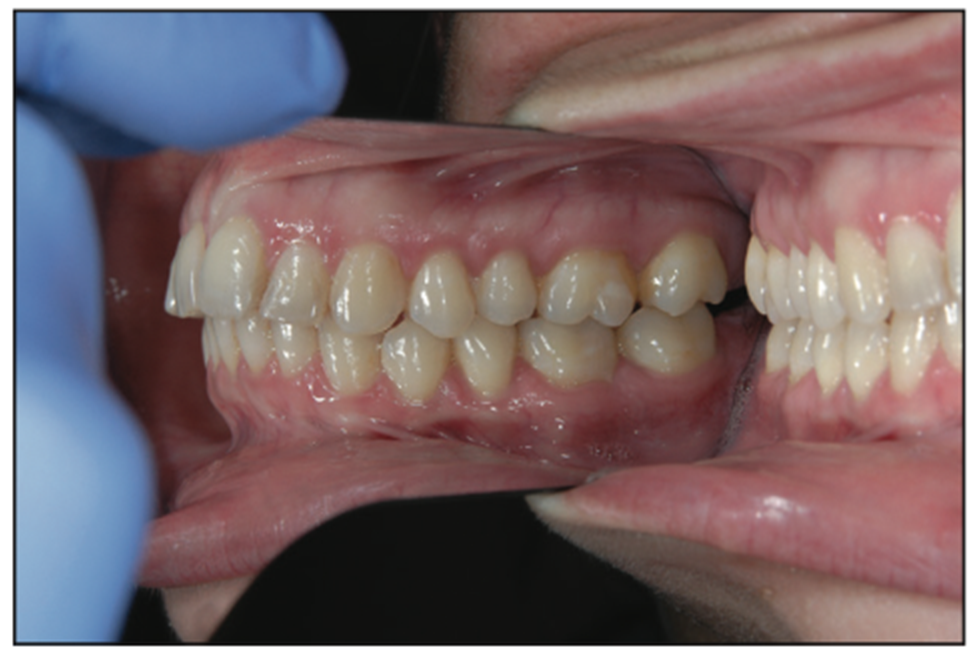 dental photography