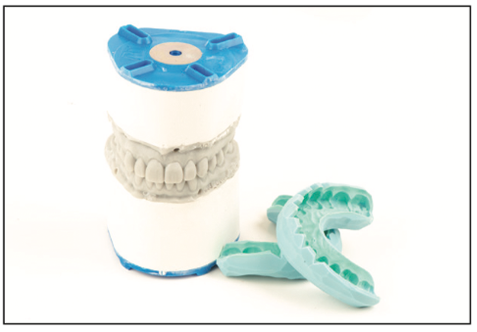 prepless smile enhancement
