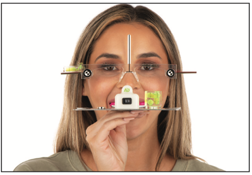 prepless smile enhancement