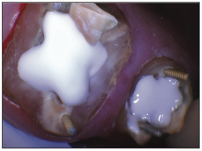digital dentistry