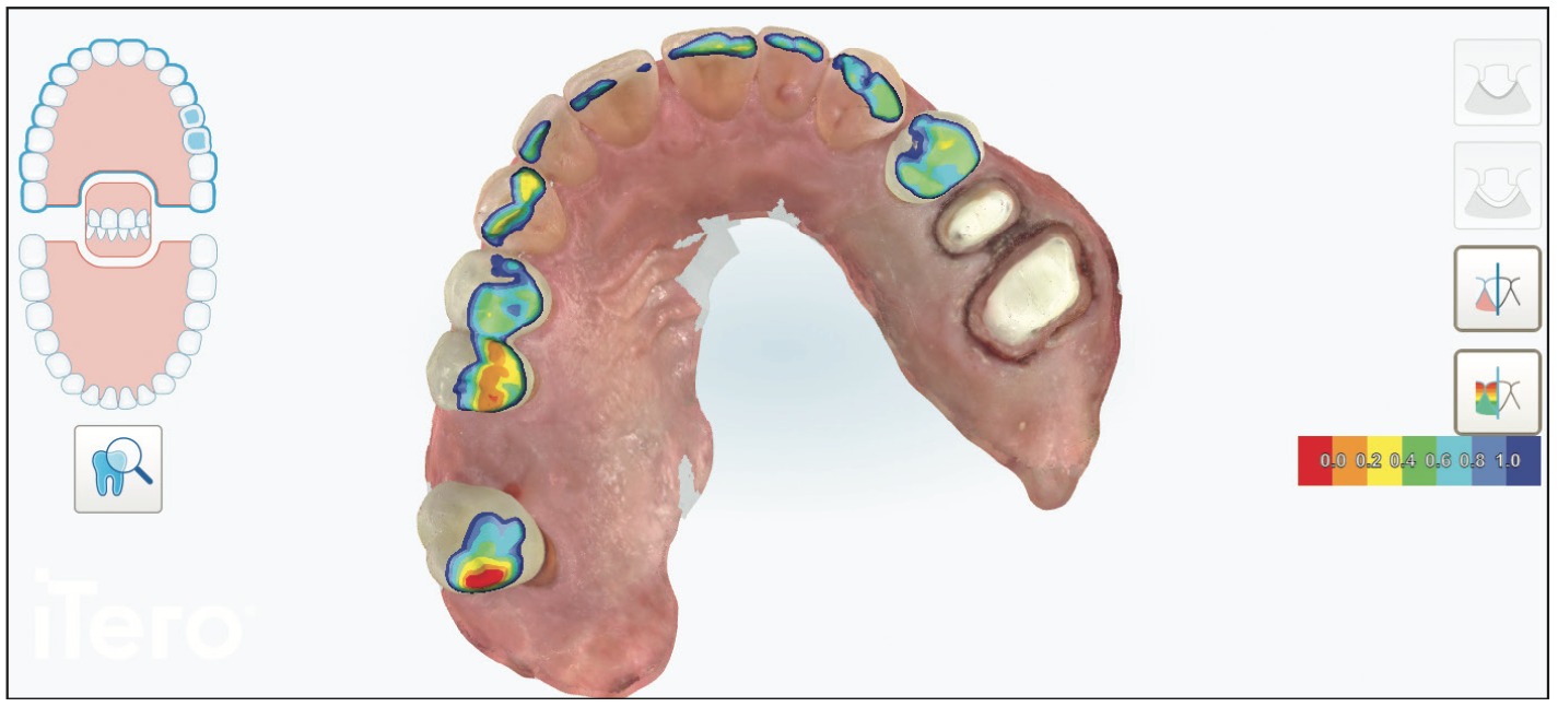 digital dentistry