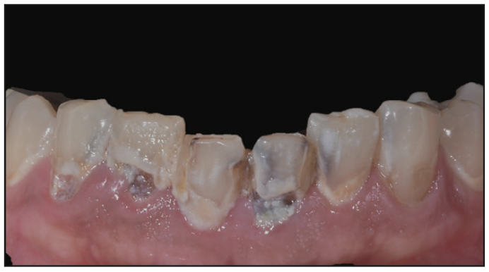 antimicrobial