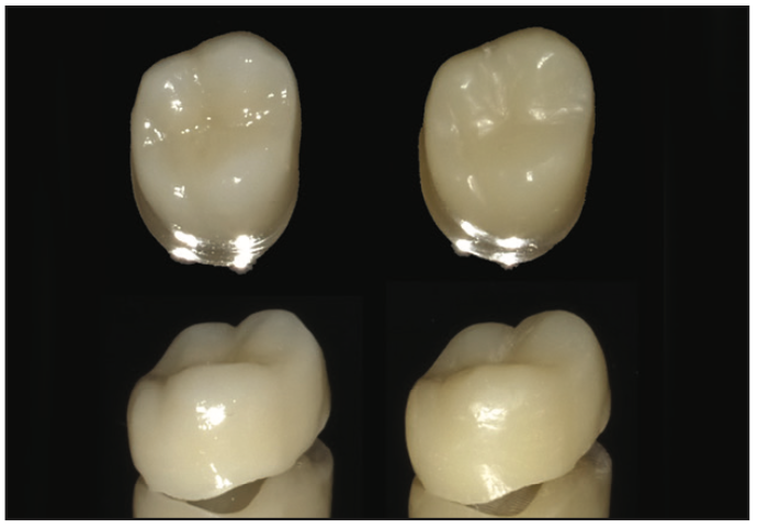ceramic-based resin