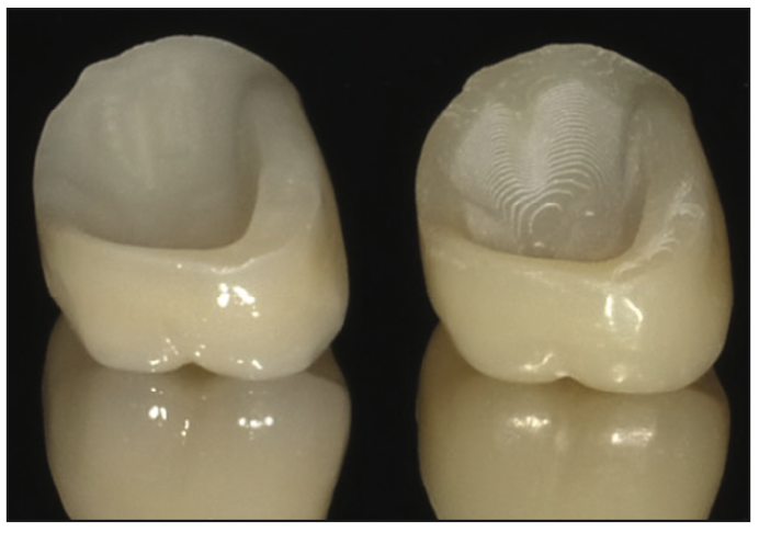 ceramic-based resin
