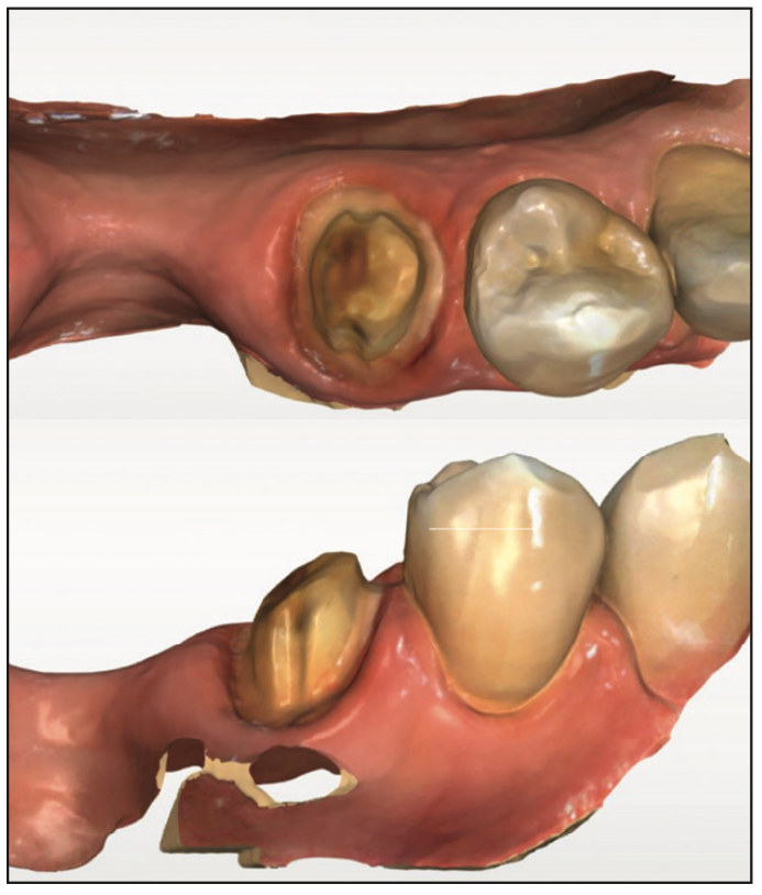 ceramic-based resin