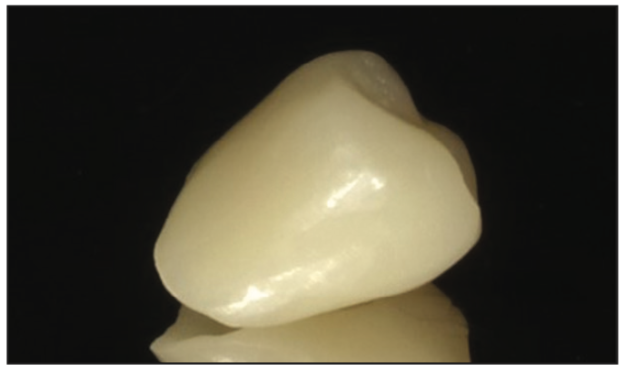 ceramic-based resin