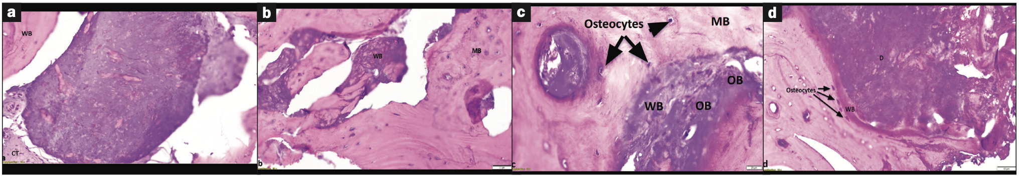 dentin grafting