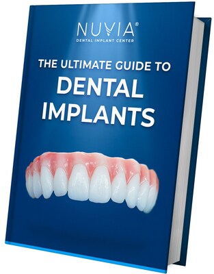 full mouth dental implants