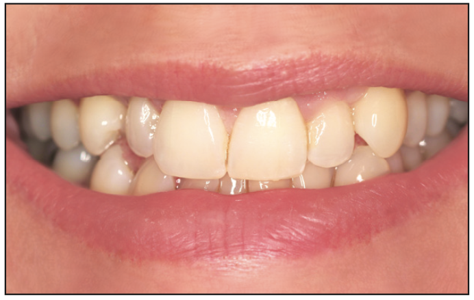 aesthetic restoration