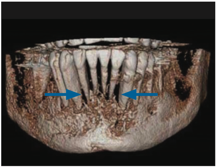 CBCT