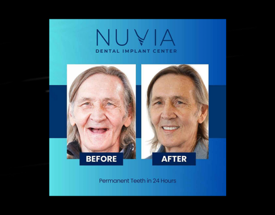 nuvia dental implant center