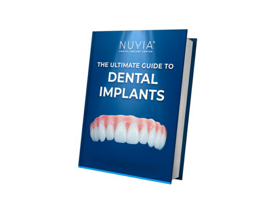 full mouth dental implants