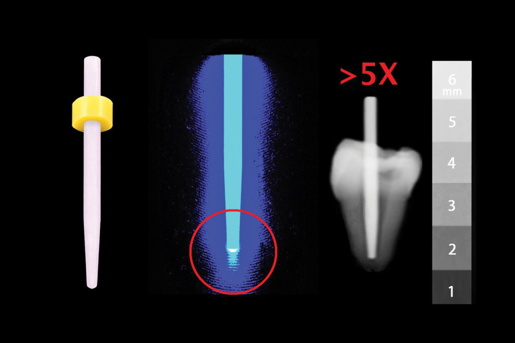 fiber posts