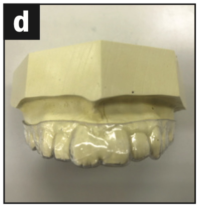 incisors