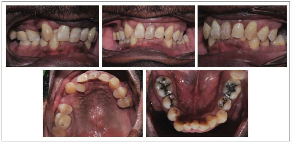 Three-Dimensional Treatment Letter