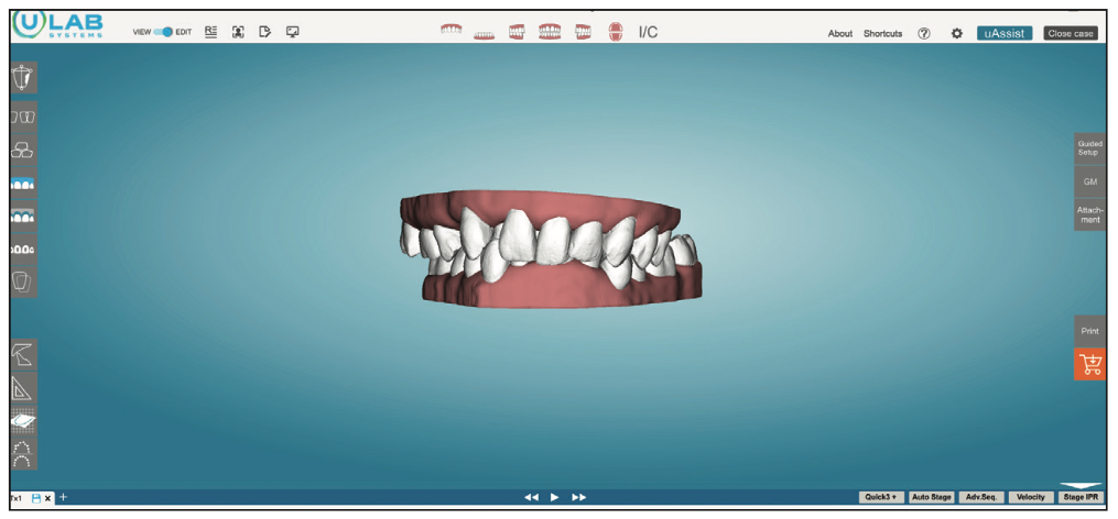 Three-Dimensional Treatment Letter