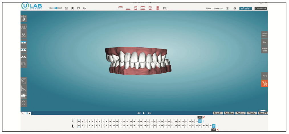 Three-Dimensional Treatment Letter