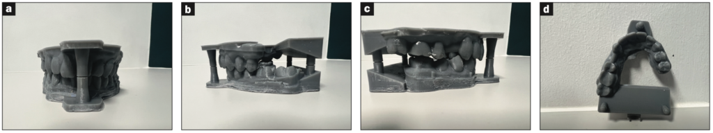 Three-Dimensional Treatment Letter