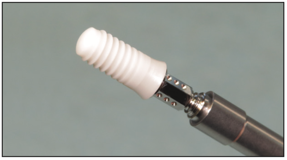 ceramic implants