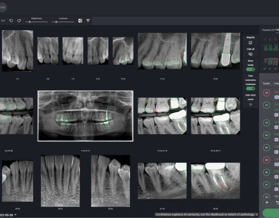 Denti.AI