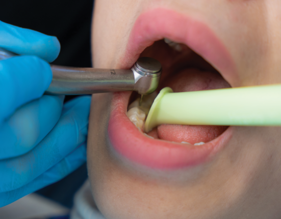 saliva ejector