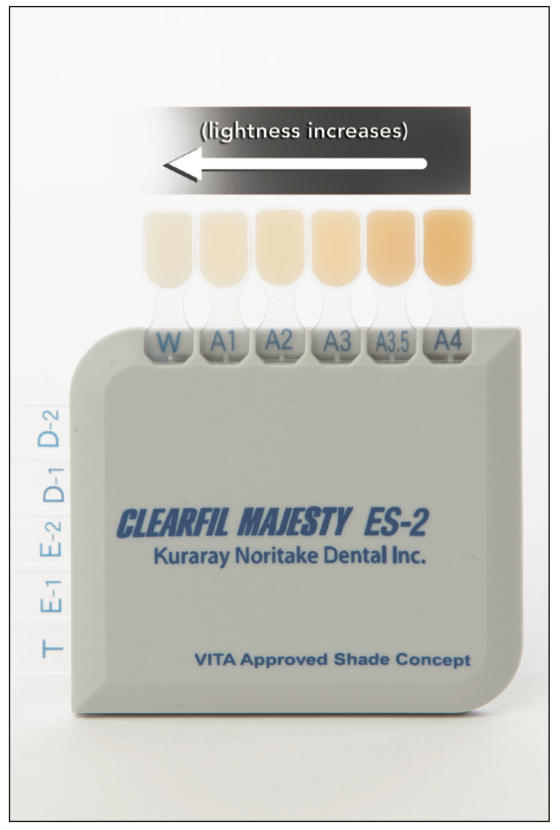 Modern Dental Composite