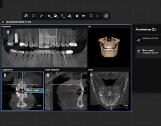 DS Core, Dentsply Sirona