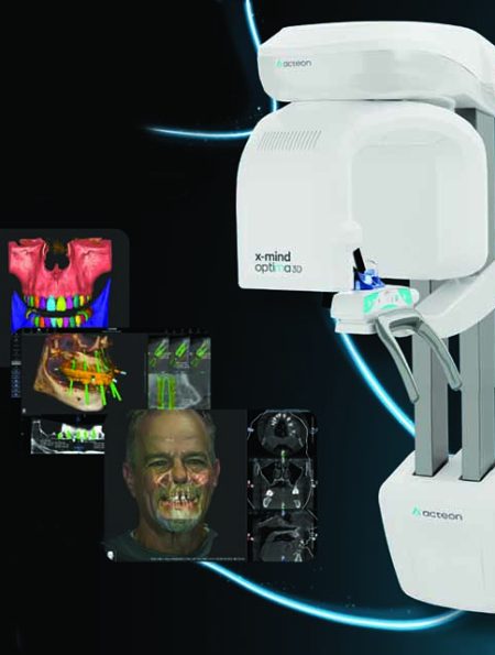 ACTEON’s X-Mind Optima 3D CBCT Streamlines Diagnostics, Treatment Planning, and Patient Communication
