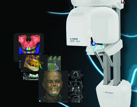 ACTEON’s X-Mind Optima 3D CBCT Streamlines Diagnostics, Treatment Planning, and Patient Communication