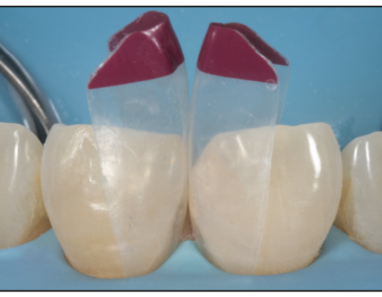 restorative dentistry