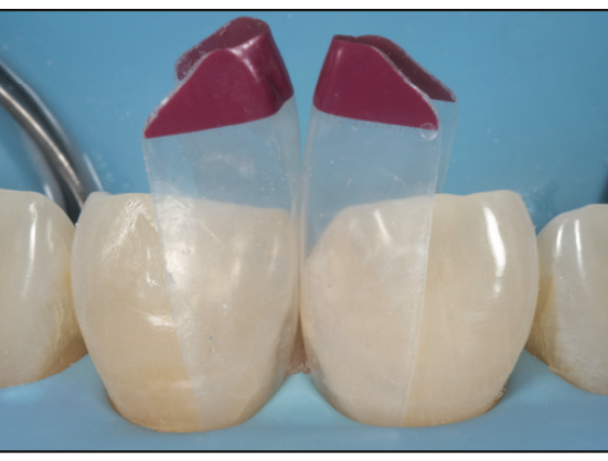 restorative dentistry