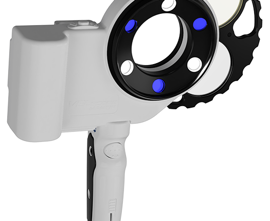 VELscope’s Updated Oral Cancer System Improves Detection and Diagnosis
