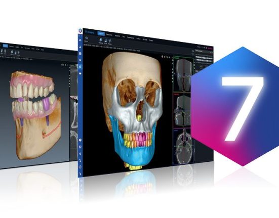 romexis 7, artificial inteligence, AI, dental imaging