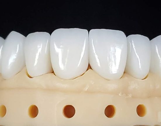 Kansas City dental lab